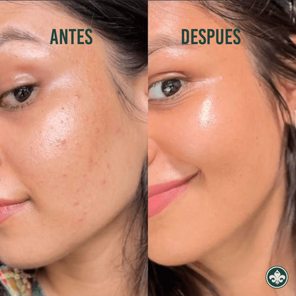 PEELING THE ORDINARY| Exfolia y mejora la textura de tu piel. 